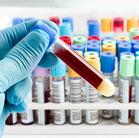 Baseline bloods, allergy and immunity investigations